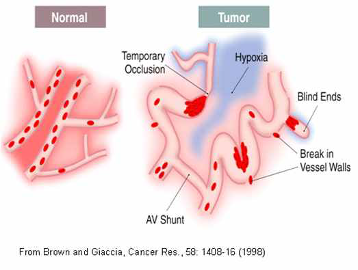 Causes for tumor hypoxia