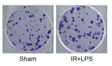 방사선 및 LPS가 처리된 대식세포의 conditioned medium이 종양세포의 colony forming ability에 미치는 영향