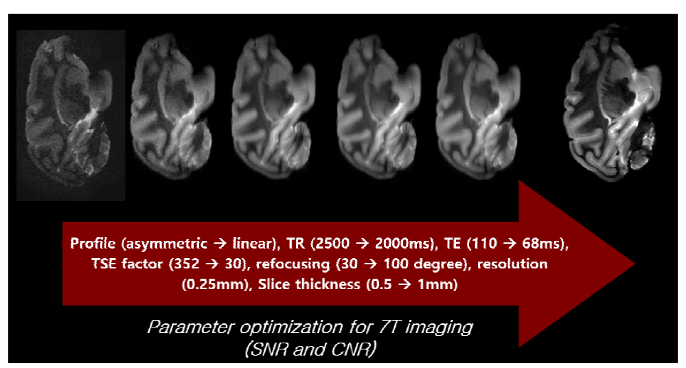 7T MRI에서 파라미터 조절에 따른 영상 품질 변화