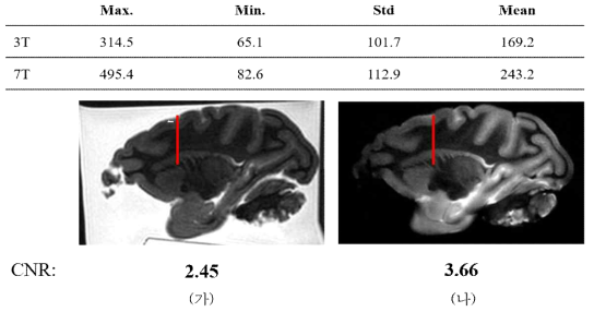 자장세기에 따른 post-mortem brain의 T2 신호강도 비교 (가: 3T, 나: 7T)