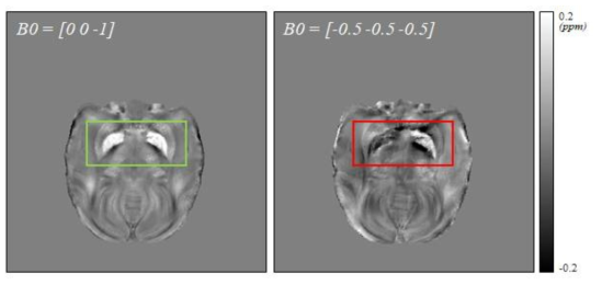 B0 방향에 따른 QSM값 비교. 임의적 방향을 사용한 QSM에서 우측 GP는 영상 대조도가 참조 이미지 (왼쪽, 녹색 상자)와 비교하여 상반한 오류를 보였다 (빨간색 상자)