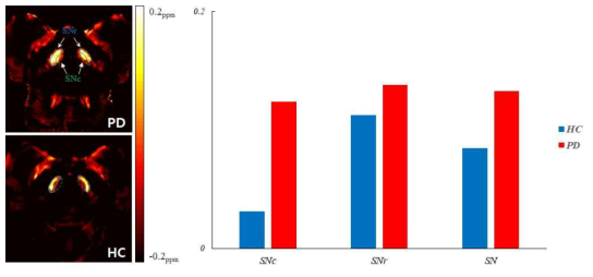 SNc 및 SNr의 정량적인 자화율값과 PD 대 대조 원숭이의 차이