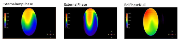 필립스 7T MRI 시스템이 지원하는 RF shimming 기능. 8채널 pTx MRI 시스템을 활용한 RF shimming 테스트. 적용 RF shimming 방법에 따라서 영상의 균질도가 매우 큰 차이를 보이는 것을 확인 할 수 있음