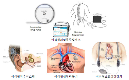 체내 이식 가능한 의료 기기 및 배터리가 요구되는 의료용 디바이스