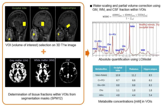 휴먼 생체 뇌 대사체 정량 분석 모식도