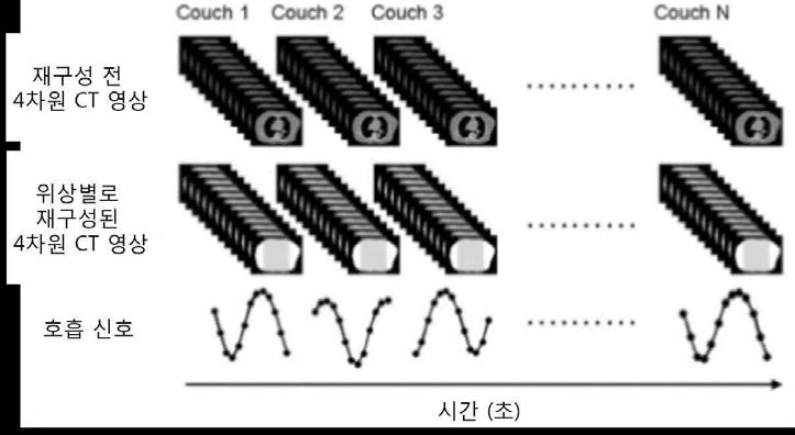 4차원 CT 촬영 절차의 개략도