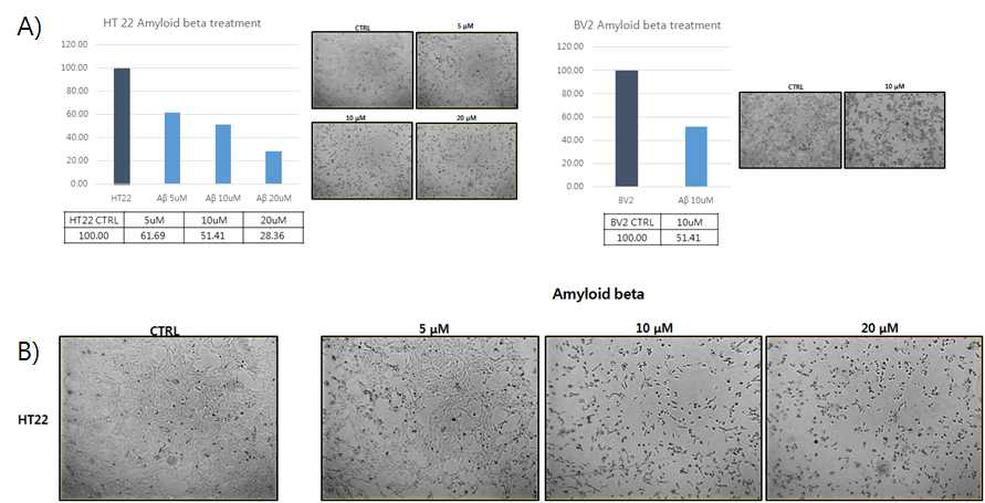 HT22 및 BV2 세포에 대한 아밀로이드 베타의 독성 실험
