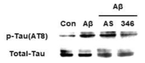 primary neuron에서 Aβ에 의해 증가한 Tau의 인산화와 DTC0346에 의한 Tau 인산화 저해 확인