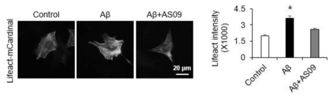 Aβ에 의한 actin polymerization 및 SHIP2 저해에 의한 회복