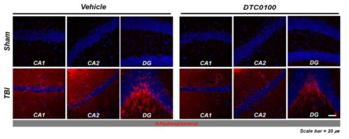 외상성 뇌손상에 따른 산화적 스트레스로 발생하는 신경세포 손상이 DTC0100에 의해 완화됨을 확인