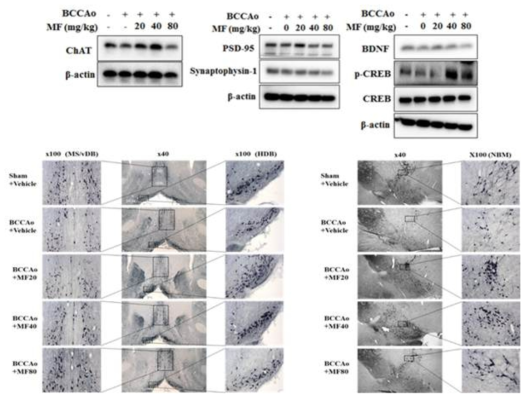 혈관성 치매 rat 동물모델에서 MF의 콜리너직 뉴런 및 기억관련 인자 정상화