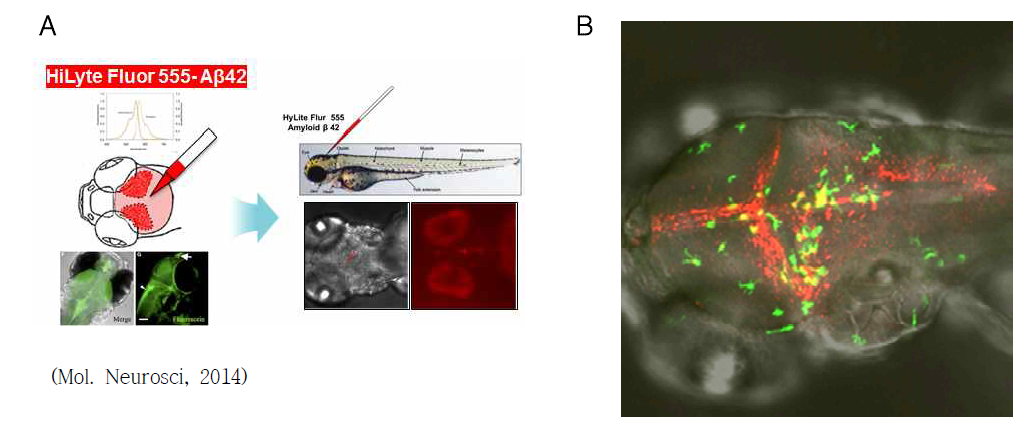 Aβ 주입에 의한 acute 제브라피쉬 AD 모델 제작. (A) 형광표지된 인간 Aβ의 뇌실 미세주입에 의한 acute AD 모델 제작. (B) 고해상도 confocal 형광 이미지. red, 뇌실에 주입된 형광표지 Aβ42 (Flur555-Aβ42); green, Aβ42 제거를 위한 residential microglia 및 infiltrating macrophages