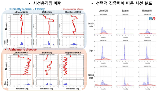 Line bisection 검사와 동시에 Lateralization 유도를 위한 Optokinetic stimulation (OKS) 제시했을 시에 시선움직임 패턴과 시선 분포에 따른 선택적 집중력 차이 분석