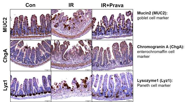 방사선 위장관 손상에 대한 pravastatin의 효과:intestinal stem cell differentiation (epithelium composition)