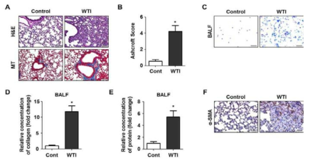 Establishment of IR-induced mouse lung fibrosis model