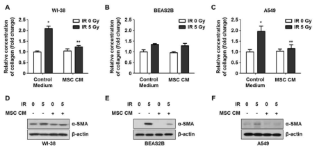 Changes of collagen levels and alph-smooth muscle actin (SMA) in non-irradiated and irradiated cells 72h after post-irradiation