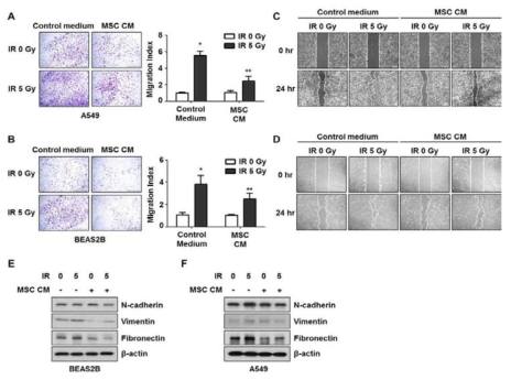 Analysis of EMT changes and migration activity in non-irradiated and irradiated cells 72h after post-irradiation