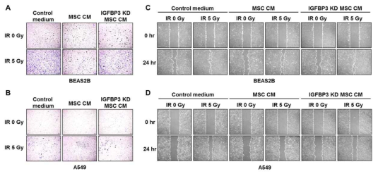 IGFBP3 inhibits EMT changes and migration activity in irradiated cells