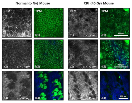 RCM and TPM images of the CRI mouse hindlimb skin on day 8 postirradiation