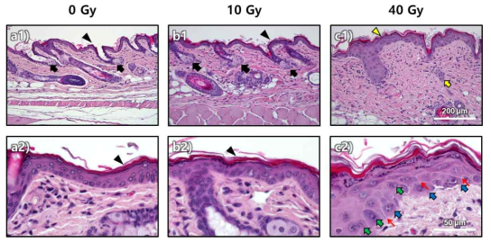 Histological images of the CRI mouse hindlimb skin on day 6 postirradiation. thin epidermis (black-arrowhead), intact hair follicle and sebaceous glands (black-arrow), thickened epidermis (yellow-arrowhead), and partial or complete loss of hair follicle and sebaceous glands (yellow-arrow), increased intercellular spaces (red-arrow), presence of hypertrophic cells (blue-arrow), multinucleated cell (green-arrow)