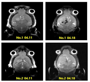 대조군의 T2강조 MRI 영상