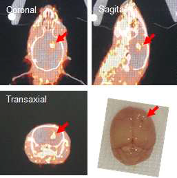 BLI와 MRI 영상으로 확인된 U87MG-hCTR1-fLuc 정위 뇌암 마우스 모델에서 hCTR1 발현에 의한 종양 특이적 Cu-64 섭취를 PET 영상으로 확인
