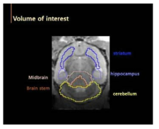 마우스 뇌를 공간표준화 시킨 후에 제작한 뇌 template와 관심영역 (volume of intertest) 설정