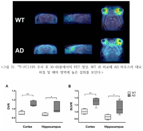 대뇌 피질 및 해마 영역 내 DVR 및 주사 후 30 ~ 60분에서의 SUVR 결과. 두 영역