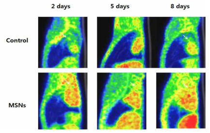 대조군 마우스와 죽상동맥경화증 마우스에서의 PET-CT 영상