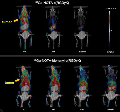 68Ga-NOTA-c(RGDyK) (위), 68Ga-NOTA-2P-c(RGDyK)(아래) in vivo PET 영상