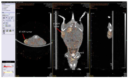 I-125 SPECT/CT 영상 획득