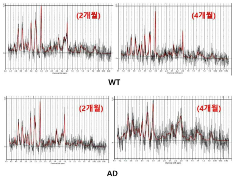 LC model 을 이용한 MRS 분석결과; 정상 마우스 (위), 5xFAD 알츠하이머 마우스(아래)