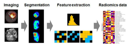 다중영상을 이용한 Radiomic data 추출 모식도