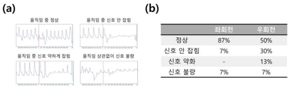 (a) 운전 중 움직임에 따른 광혈류량 신호에 부가되는 아티팩트 파형. (b) 좌회전 및 우회전에 따른 아티팩트 발생빈도 비교