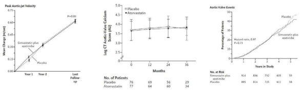대동맥판막 협착증 진행 억제 시도: 스타틴의 임상적 억제 실패