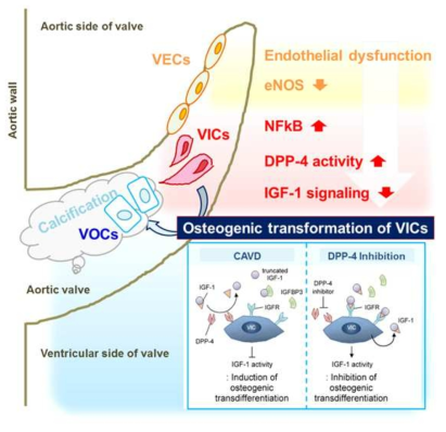 대동맥판막 석회화 유도 과정에서의 DPP-4의 역할