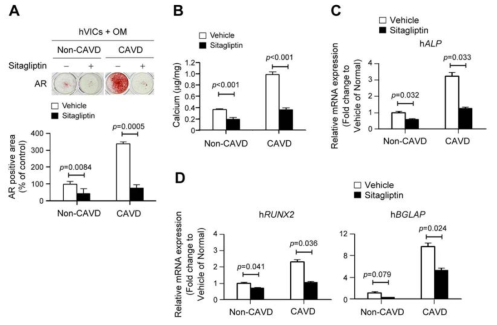 정상 및 CAVD 환자의 VIC를 이용한 골세포성 분화 비교 및 DPP-4 저해제 Sitagliptin에 의한 석회화 억제 효과 확인