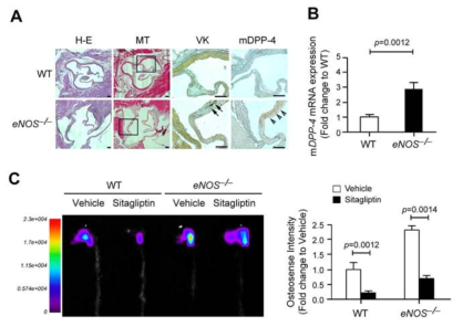 eNOS 결핍 마우스의 대동맥판막에서의 DPP-4 단백질 발현과 석회화 증가 및 DPP-4 저해제에 의한 석회화 감소