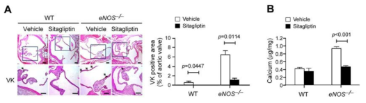 eNOS 결핍 마우스의 대동맥판막에서의 DPP-4 저해제에 의한 석회화 감소