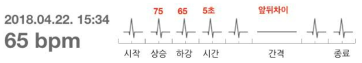 심박(ECG) 기록