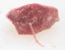 폐장의 기관지 내에서 발견된 폐충