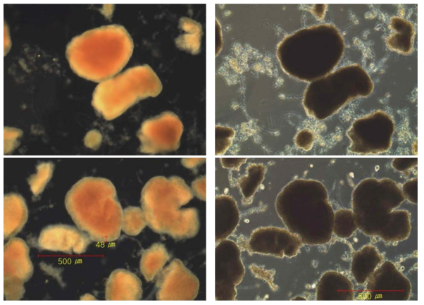 아나목스 그레뉼의 현미경 사진 모습 (100배, 좌: DF모드 촬영, 우: 위상차 모드 촬영)