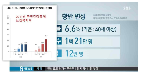 국내 황반변성 발병률