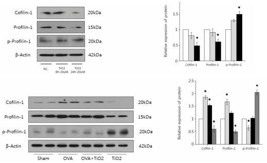 인간기관지세포와 동물에서의 Cofilin-1, Profilin-1,p-profilin-1 단백 수준분석