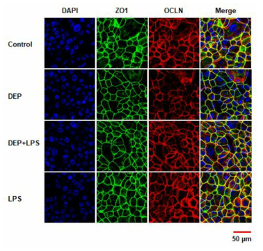 일차 인체 비강상피세포의 배양 ALI 12일에서의 ZO1 과 occludin의 세포막에서의 발현 및 DEP에 의한 ZO1 과 occludin의 재배열 및 그에 미치는 LPS의 영향