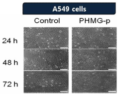 A549 세포에서 PHMG-p에 의한 시간별 형태학적 변화