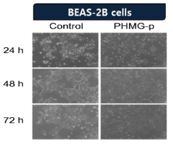 BEAS-2B 세포에서 PHMG-p에 의한 시간별 형태학적 변화