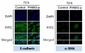 면역형광을 통한 PHMG-p의 상피간엽이행관련 단백질발현 변화