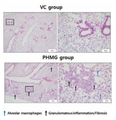 PHMG 유도 폐섬유증 모델에서의 병리조직학적 검사 소견