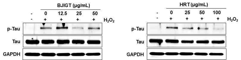치매 한약처방의 Tau 단백질 인산화에 대한 영향
